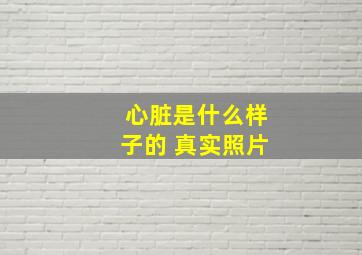 心脏是什么样子的 真实照片